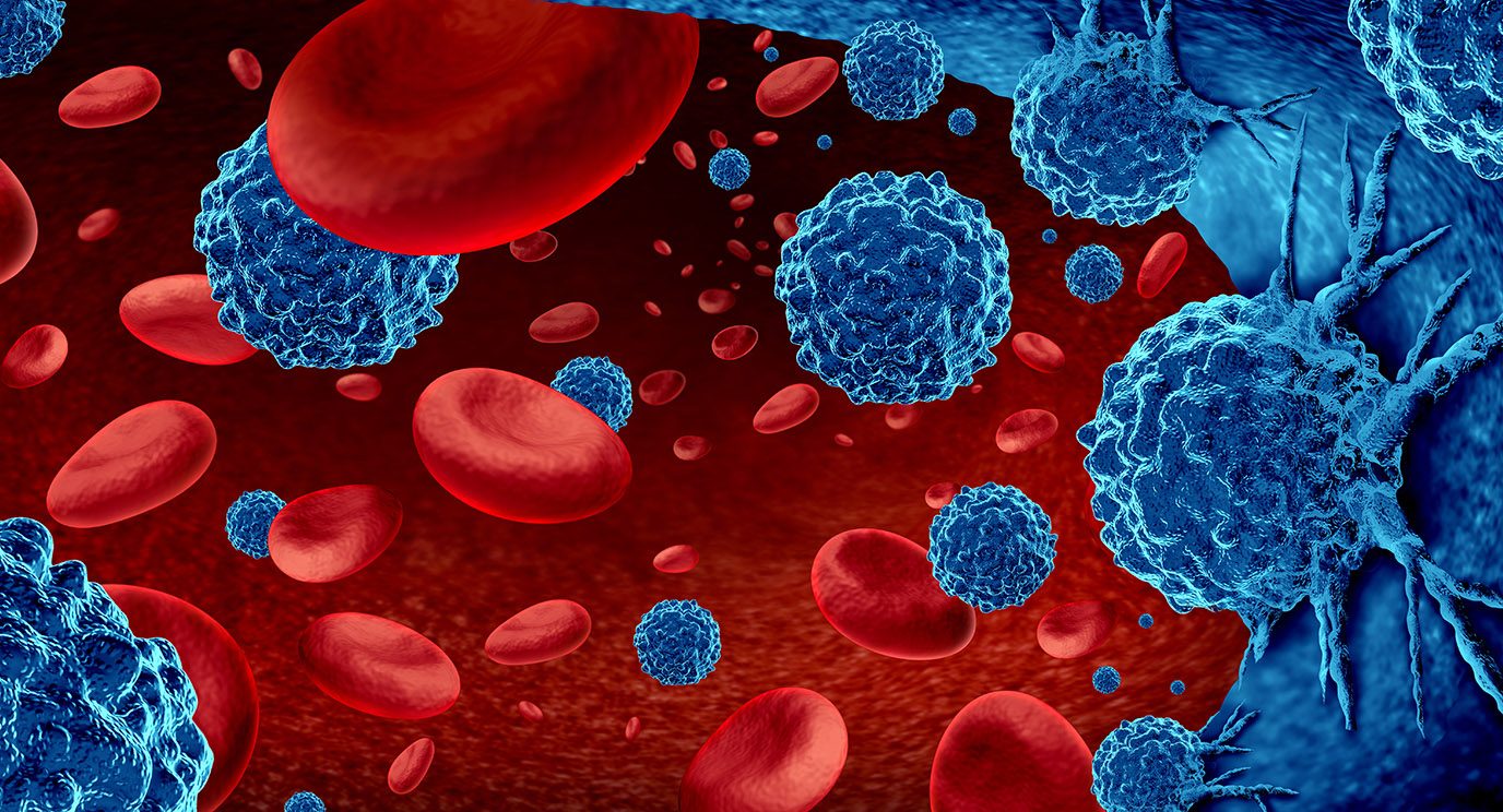 插图漂浮在血液中红细胞的蓝色的癌细胞