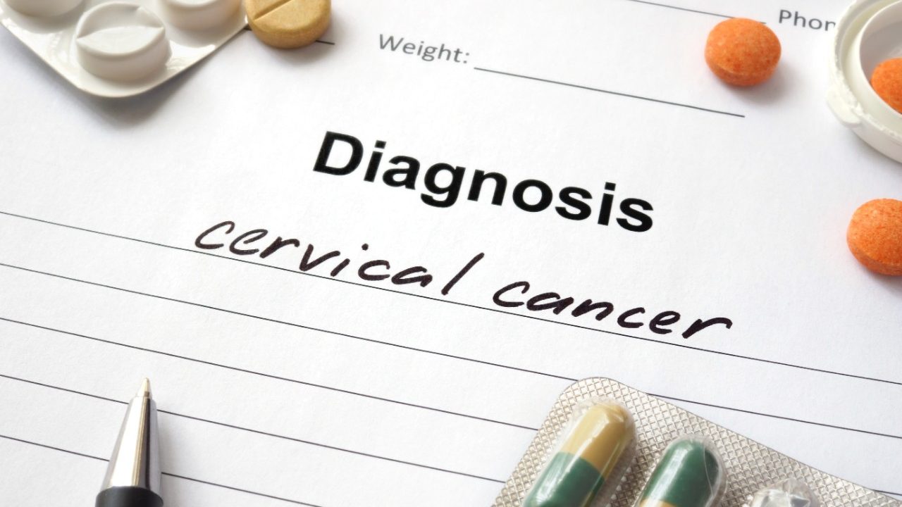 Cancerwise博客:了解宫颈癌神话