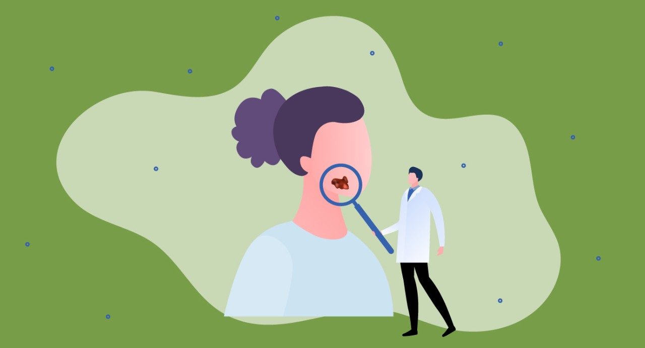 Graphic of stylized doctor examining growth on woman's face