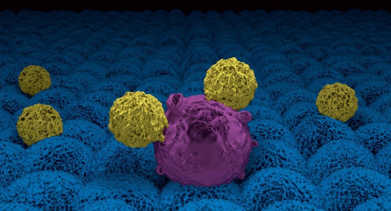二小黄CART细胞攻击一大紫癌细胞上层多蓝细胞