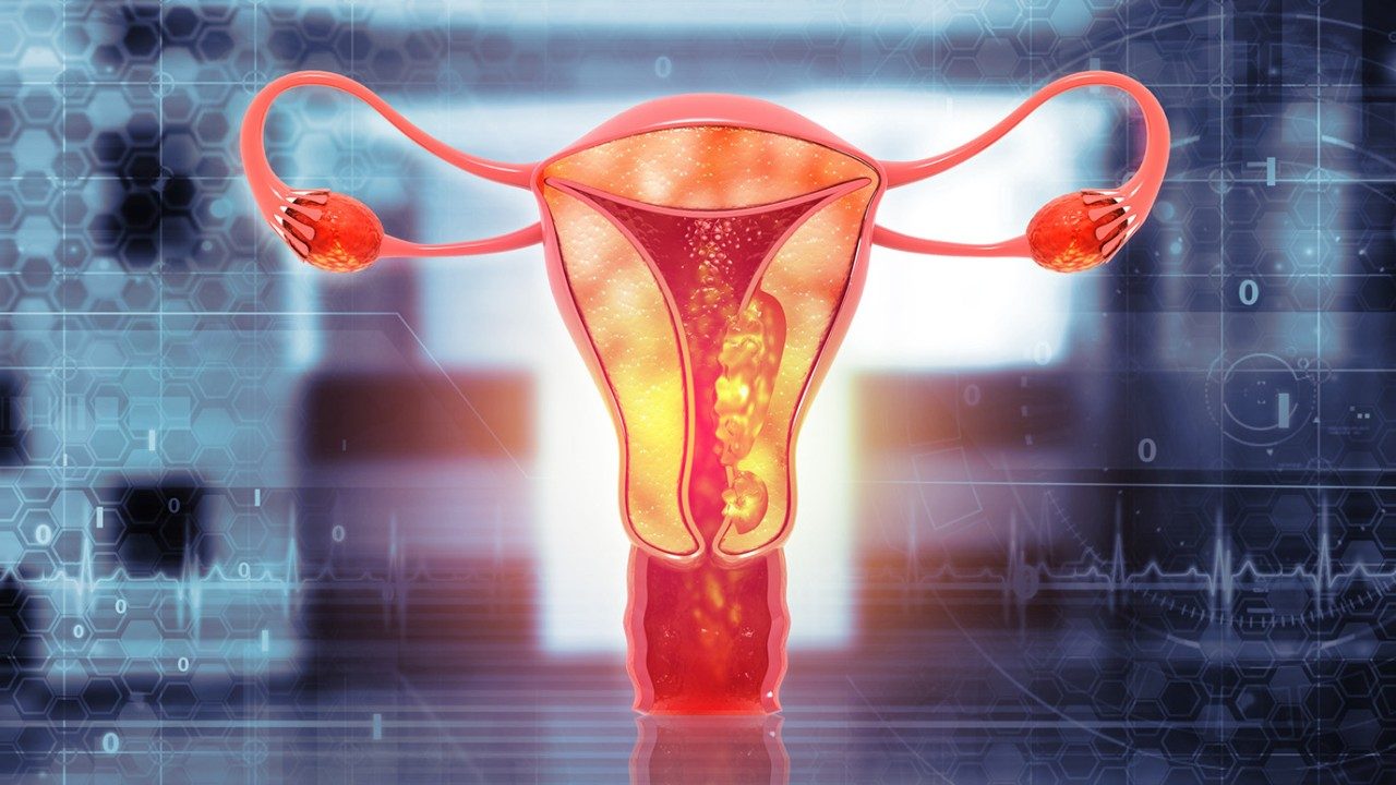 医学插图显示女性内部生殖系统与繁忙灰色抽象背景