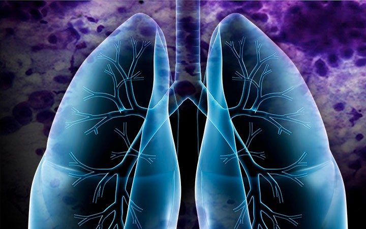 肺与活组织检查